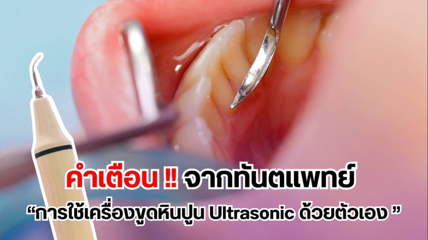 คำเตือนจากทันตแพทย์ “การใช้เครื่องขูดหินปูน Ultrasonic ด้วยตัวเอง”