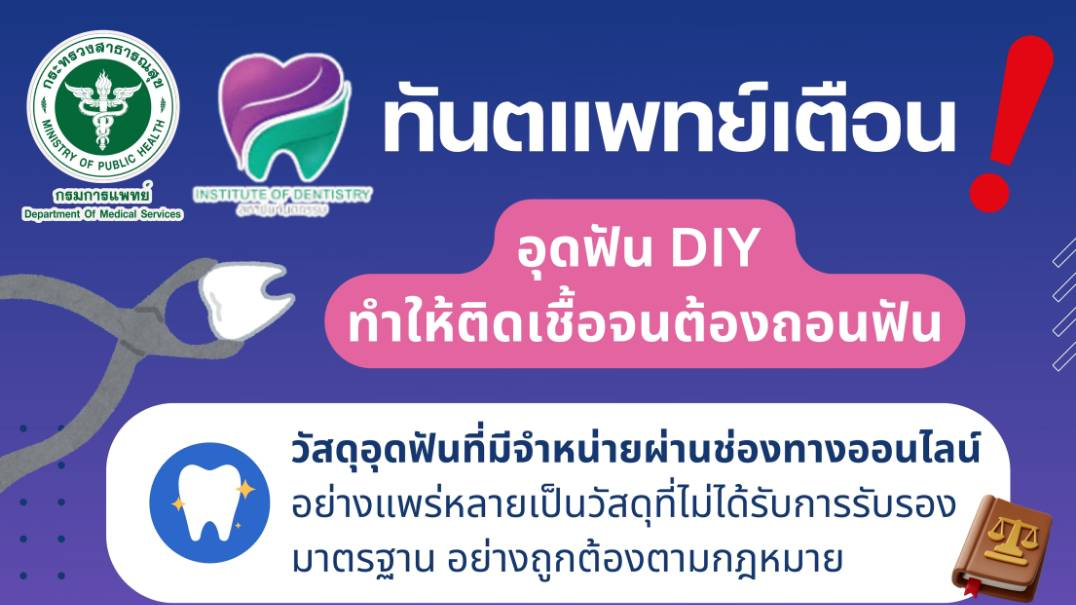 ทันตแพทย์เตือน! อุดฟัน DIY ทำให้ติดเชื้อจนต้องถอนฟัน