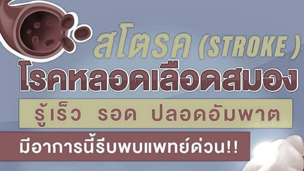 เช็กอาการเตือน “โรคหลอดเลือดสมอง” แนะสังเกตสัญาณเตือน แนวโน้มผู้ป่วยสูงขึ้นทุกปี