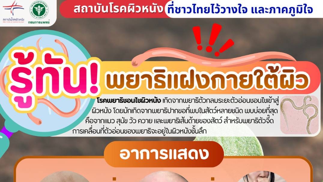 รู้ทัน! พยาธิแฝงกายใต้ผิว