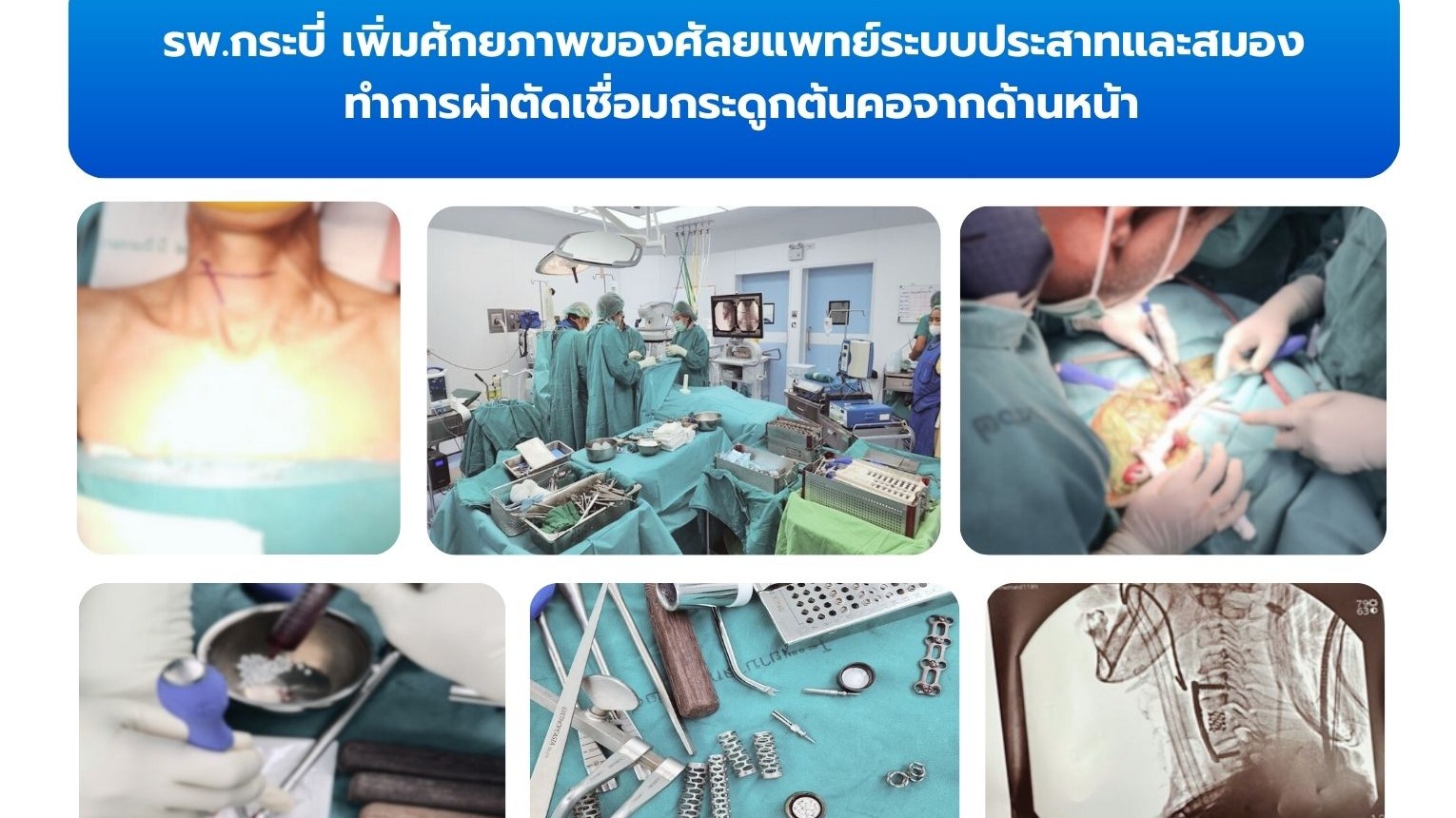 รพ.กระบี่ เพิ่มศักยภาพของศัลยแพทย์ระบบประสาทและสมอง 