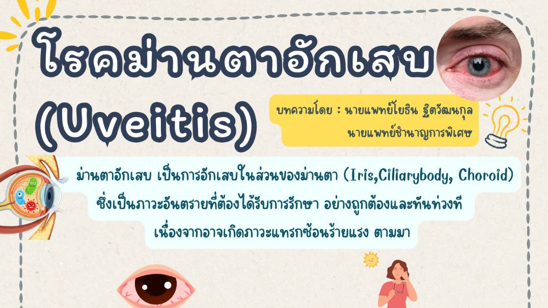 รพ.เมตตาฯ เผยม่านตาอักเสบ (Uveitis) ทำไงดี!