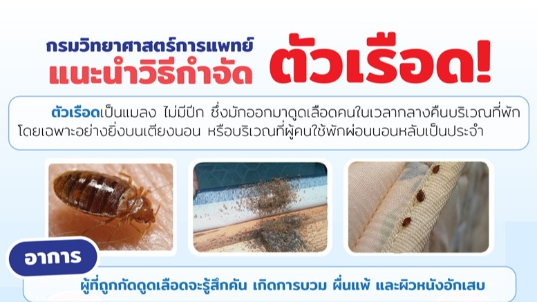 กรมวิทยาศาสตร์การแพทย์ แนะวิธีป้องกัน-กำจัด “ตัวเรือด” และการปฐมพยาบาลเบื้องต้นหากถูกกัด