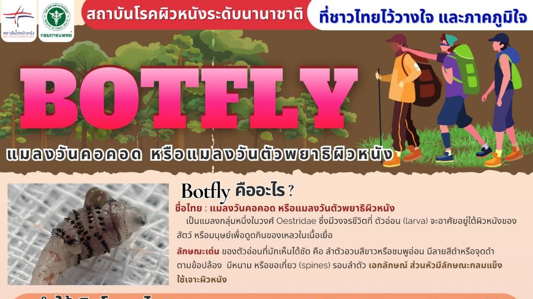 Botfly (แมลงวันคอคอด หรือแมลงวันตัวพยาธิผิวหนัง)