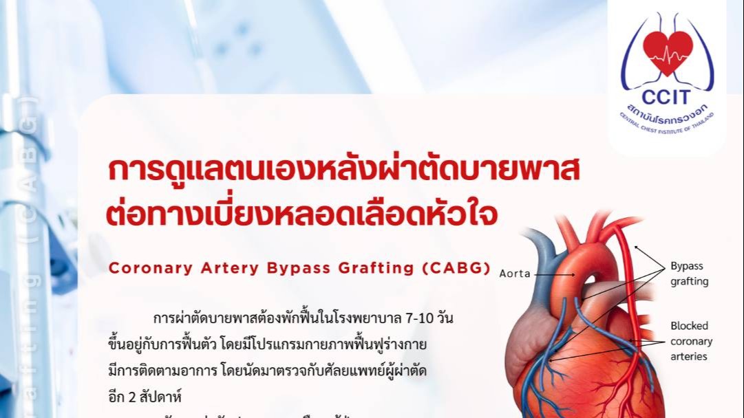 กรมการแพทย์ แนะการดูแลตนเองหลังการผ่าตัดบายพาสต่อทางเบี่ยงหลอดเลือดหัวใจ  (Coronary Artery Bypass Grafting หรือ CABG) รู้ทันอาการ รักษาทันเวลา ลดเสี่ยงเสียชีวิต