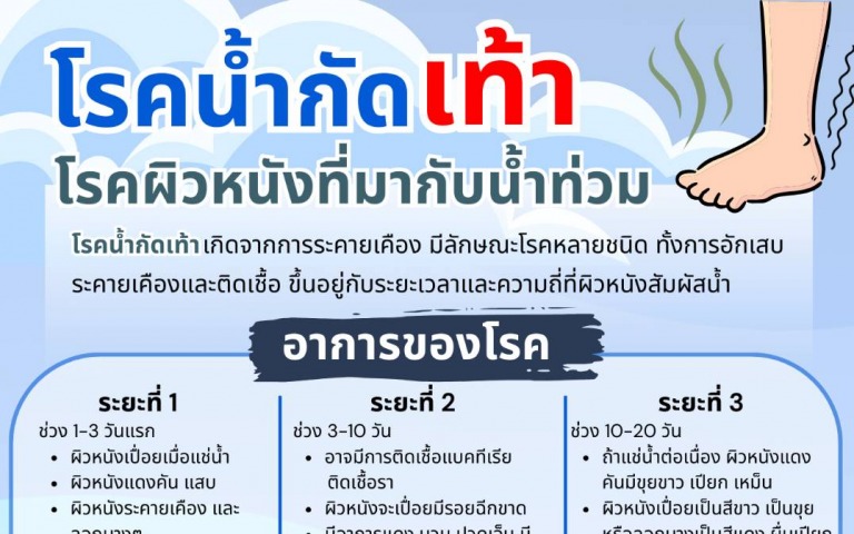 โรคน้ำกัดเท้า โรคผิวหนังที่มากับน้ำท่วม