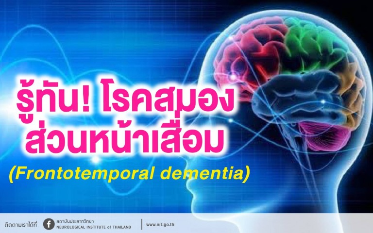 กรมการแพทย์ แนะรู้ทัน! โรคสมองส่วนหน้าเสื่อม (Frontotemporal dementia)