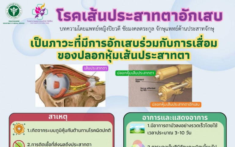 รพ.เมตตาฯ อาการเป็นเส้นประสาทตาอักเสบ อันตรายไหม !