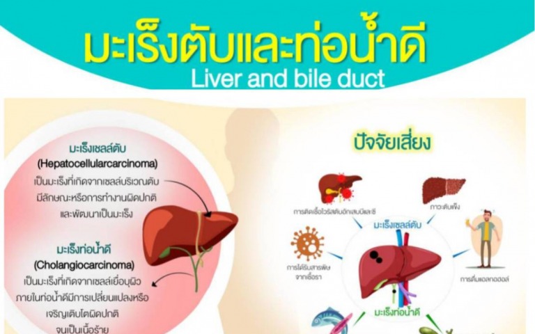 “มะเร็งตับและท่อน้ำดี” ภัยเงียบที่คนไทยต้องระวัง